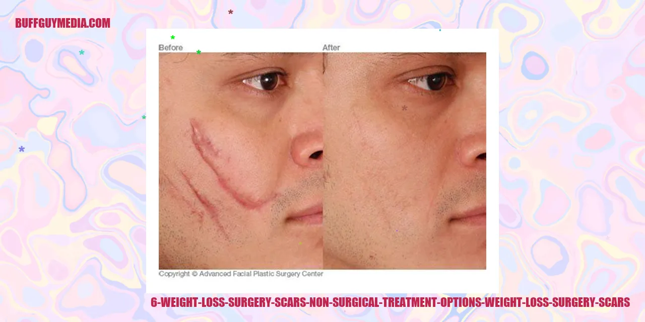 Weight Loss Surgery Scars Non-surgical Treatment Options